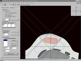 ScanPlan Planning System