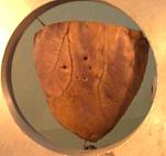 A fragment of myocardium wall of an adult man (10-14 mm)
